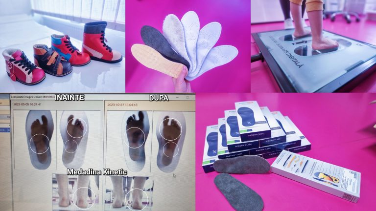 CONSULT PENTRU SUPORTI PLANTARI PERSONALIZATI